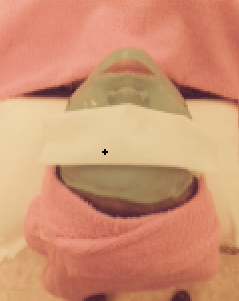 Massage mặt